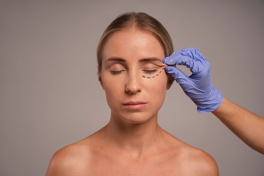Lifting de sprâncene, liftingul facial și ce alte proceduri estetice sunt la mare cerere în 2026?