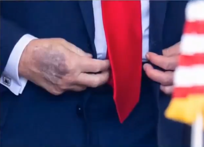 NEWS.ro: În faţa criticilor, Trump repetă că este „în perfectă sănătate”