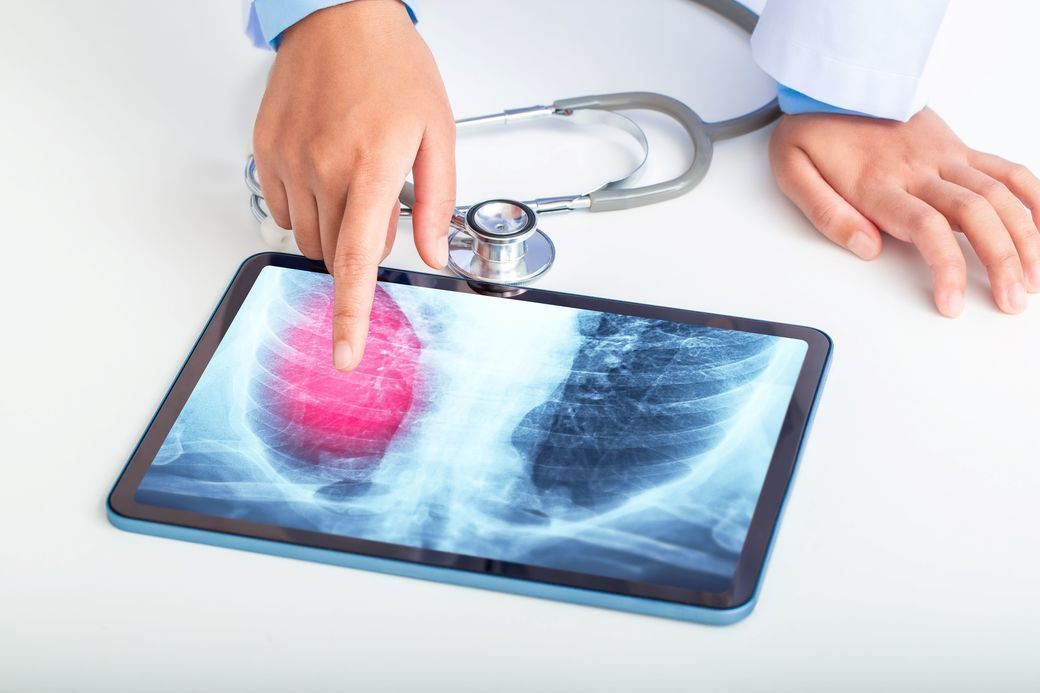 NEWS.ro: Mutaţiile care provoacă rezistenţă la tratamentul cancerului, potenţiale ţinte pentru noi imunoterapii