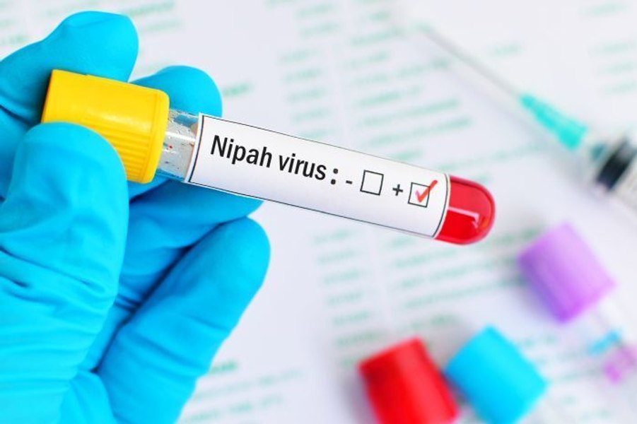 Virusul Nipah revine în atenția autorităților după noi focare în India. Ce este, cum se transmite și cât de mare este riscul