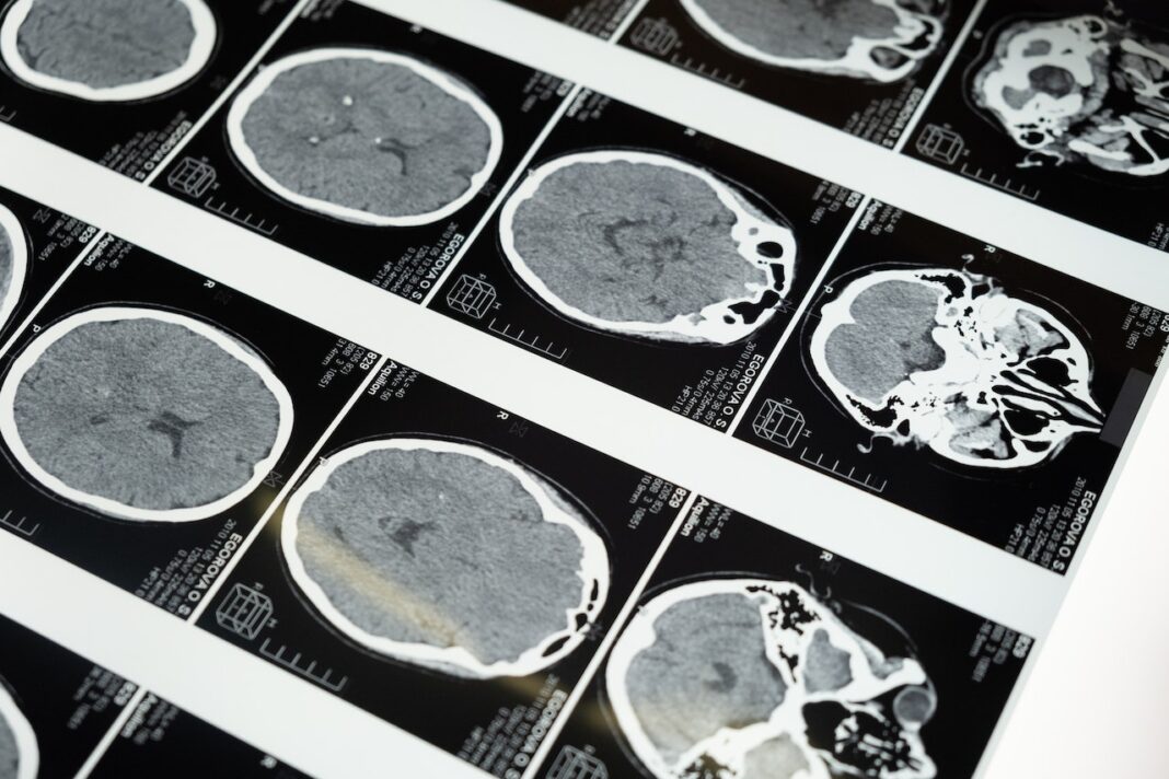 Criză de medici radiologi în spitalele din țară / Manager de spital: „În gărzi, au fost nopți cu 20-30 de investigații CT” / O posibilă soluție ar fi telemedicina