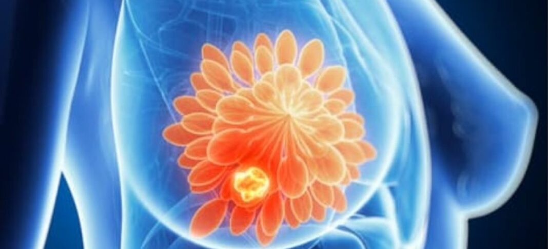 NEWS.ro: Schimbarea timpurie a tratamentului oncologic, înainte de recidivă, ar putea îmbunătăţi şansele de vindecare în cancer