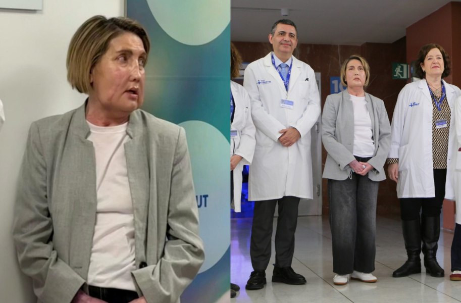 Primul transplant de față din lume cu donator decedat prin eutanasie, realizat într-un spital din Barcelona