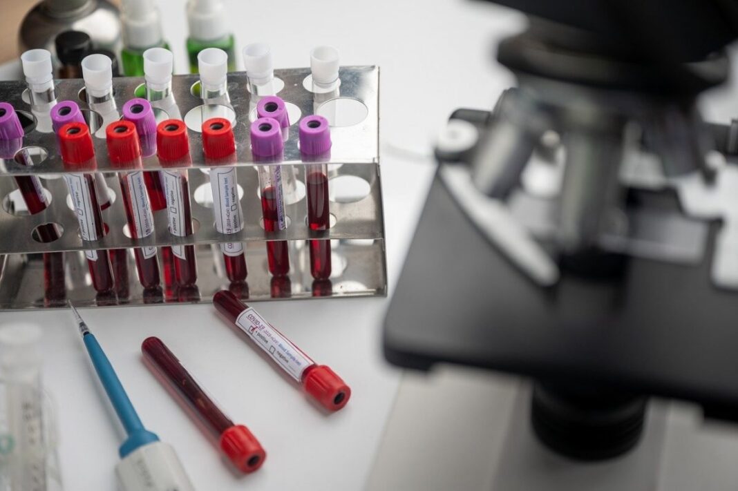 Un test de sânge ar putea depista boala Parkinson cu ani înainte de apariția simptomelor