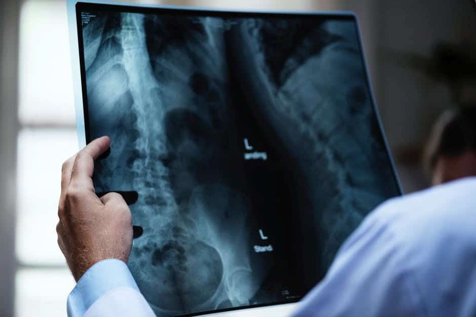 STUDIU: Fibroza pulmonară tratată prin aerosoli / Cum ar putea celulele stem să schimbe viitorul bolilor pulmonare grave