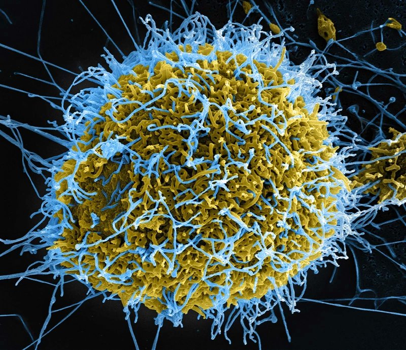 NEWS.ro: Kenya anunţă primul său deces cauzat de virusul Ebola