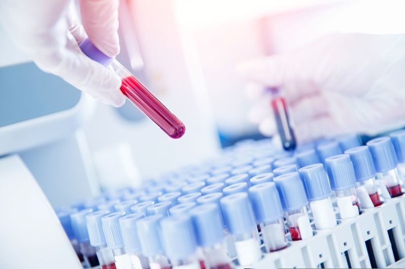 NEWS.ro: Un studiu internaţional arată că incidenţa cancerului creşte mai rapid în rândul tinerilor